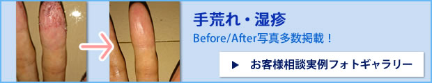 before after